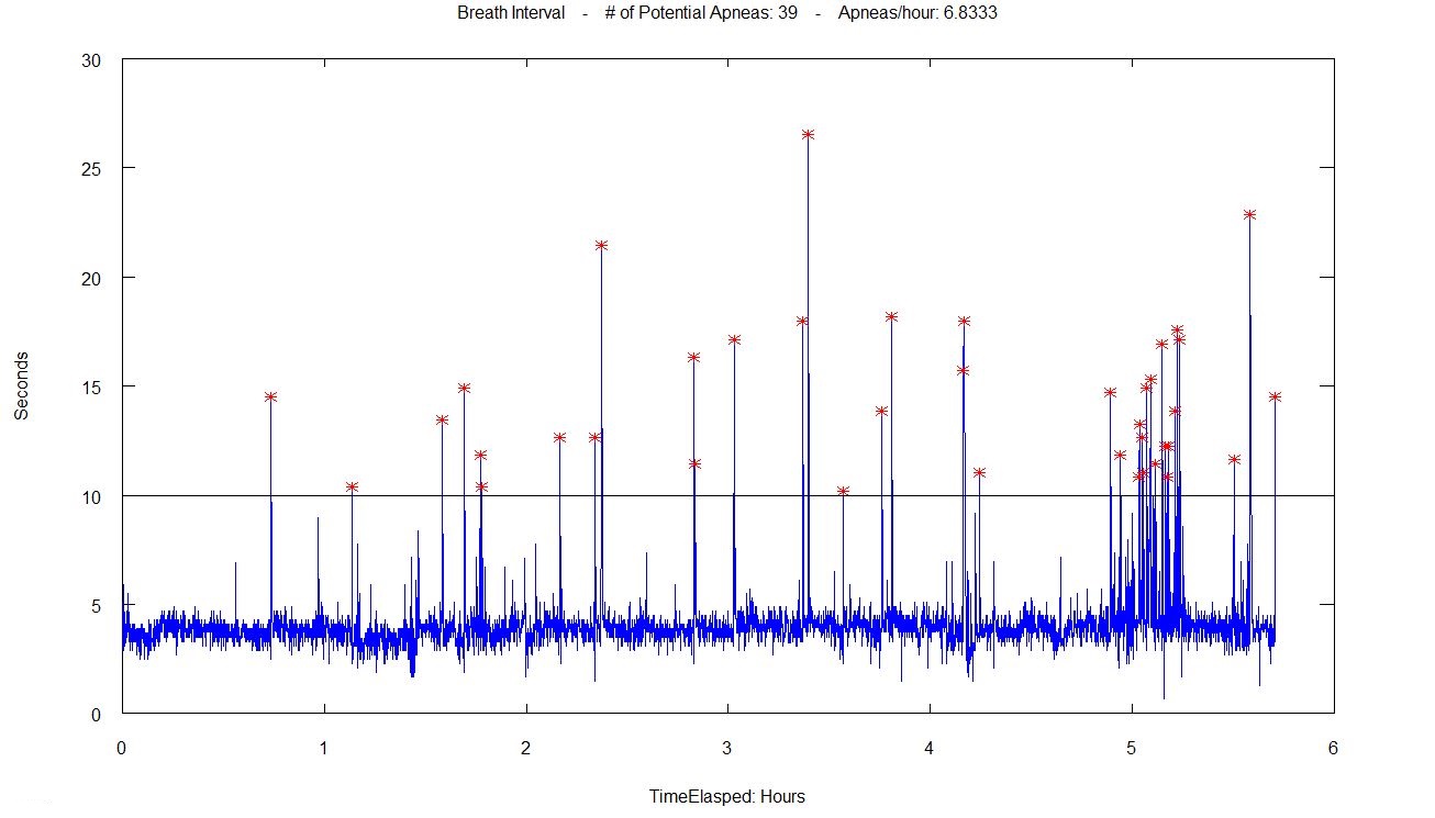 Breath Interval Plot